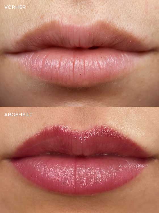 PRETTIFY Hamburg - Permanent Make-up - Lp Blush