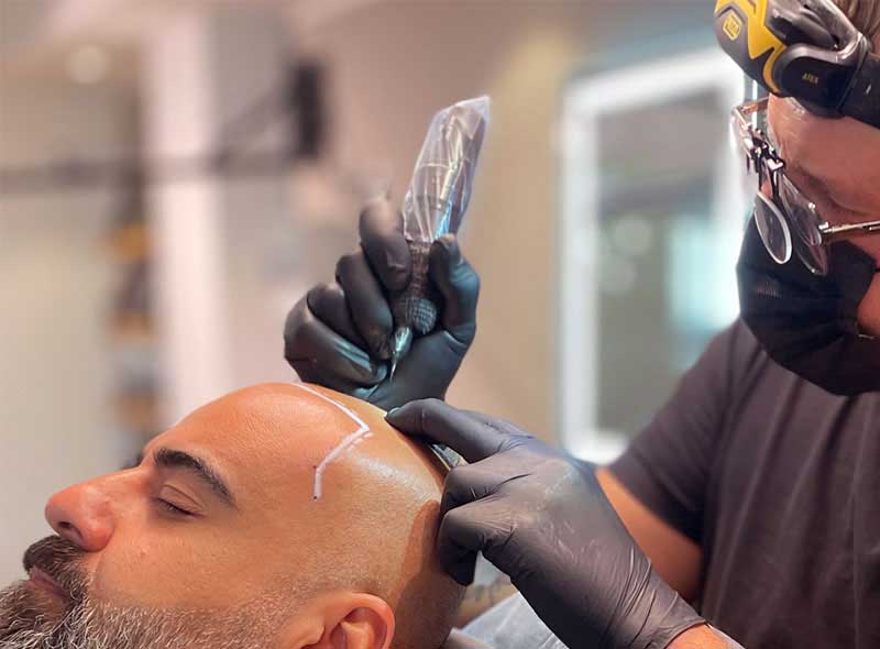 PRETTIFY Hamburg Scalp Micropigmentation Kay Elpers