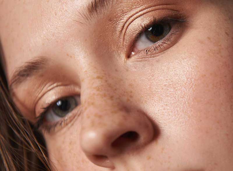 t_permanentmakeup_hamburg_freckles PRETTIFY Hamburg - Permanent Make-up - Faux Freckles